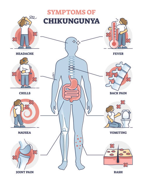 Best Chikungunya Arthritis Treatment in Ahilyanagar